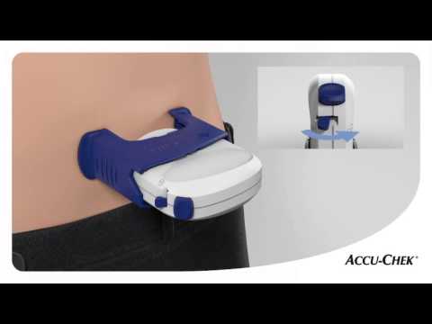 Accu-Chek FlexLink infusieset: makkelijk en automatisch in te brengen